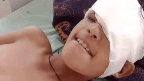 पागल कुत्ते ने एक ही दिन में तीन बच्चों को बनाया शिकार