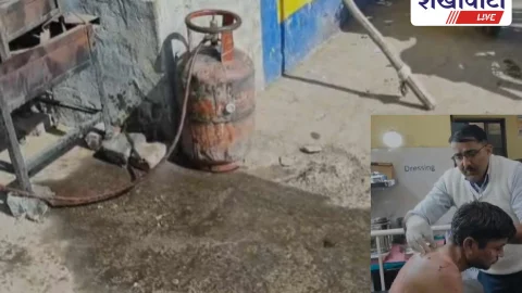 चिड़ावा में प्रसाद बनाते युवक पर गिरा गर्म तेल, झुलसा