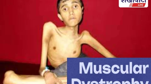 मस्क्यूलर डिस्ट्रॉफी पीड़ितों को फ्री व्हीलचेयर, 15 जनवरी तक आवेदन