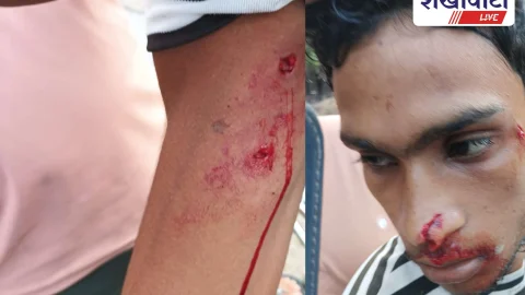 Jhunjhunu News: झुंझुनूं: उदयपुरवाटी में लेपर्ड के हमले से छात्र घायल