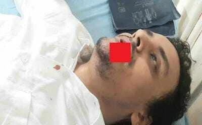 कोर्ट परिसर में हुआ दो वकीलों में झगड़ा : वकील चबा गया दूसरे वकील का होठ