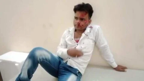 मजदूरी करने आ रहे स्कूटी सवार 3 युवकों को मारी टक्कर