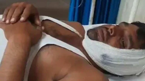 मोबाइल पर कॉल कर गाली देने के बाद युवक पर लाठियों से हमला